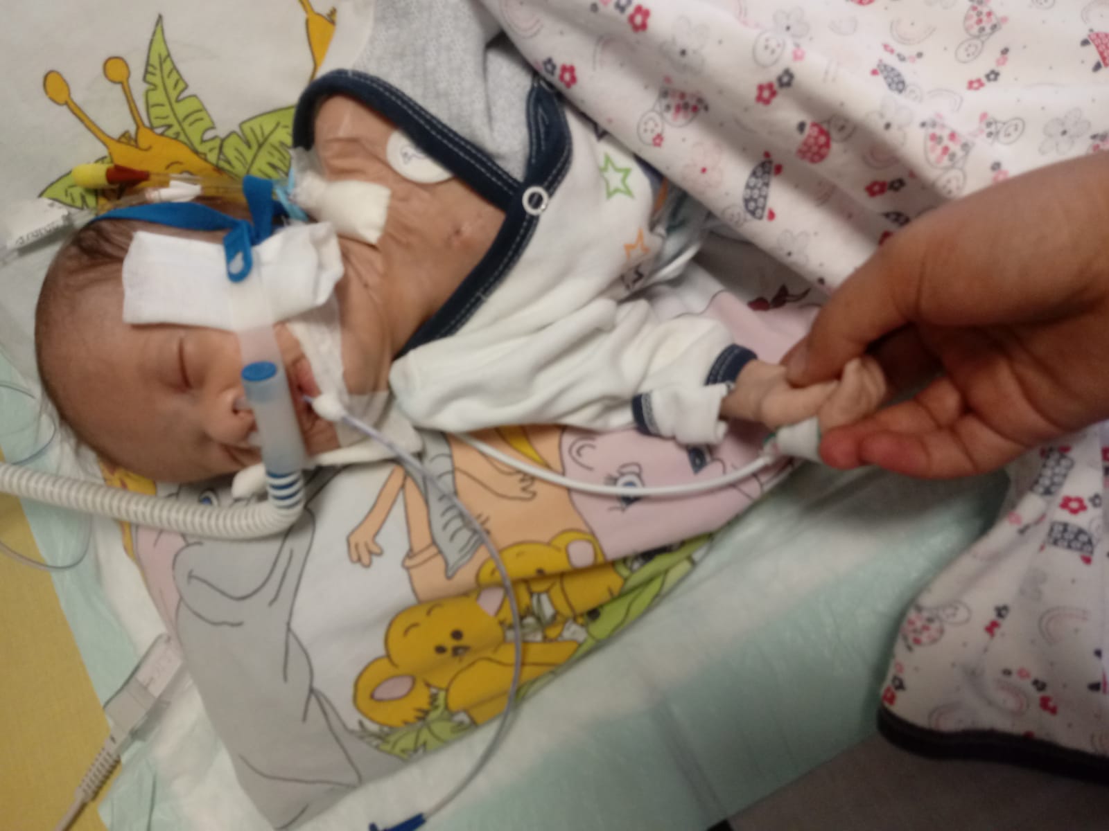 Mete Bebek yardım eli bekliyor
